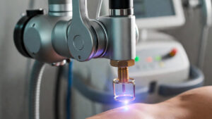 آیا لیزر درد دارد؟