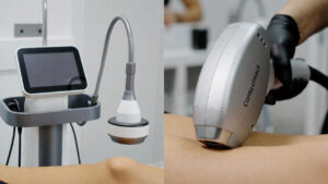 تکنولوژی لیزر غیر تماسی