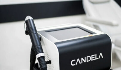 لیزر کندلا برای پوست‌های تیره