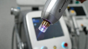 کلینیک مجهز به لیزر الکساندرایت