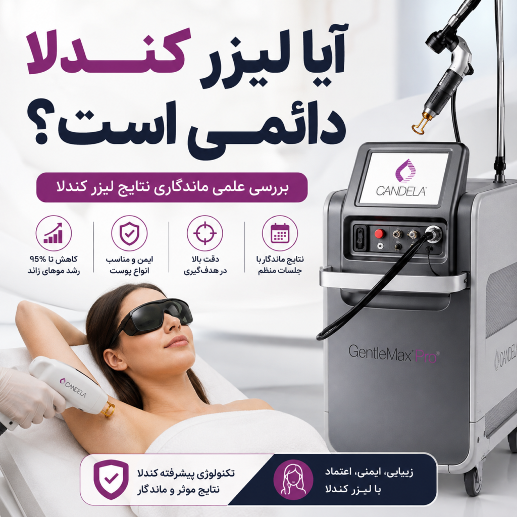 آیا لیزر کندلا دائمی است
