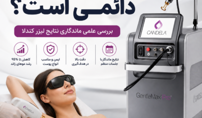 آیا لیزر کندلا دائمی است