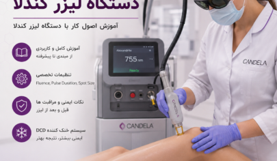 اپراتوری دستگاه لیزر کندلا