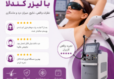 تجربه کاربران با لیزر کندلا