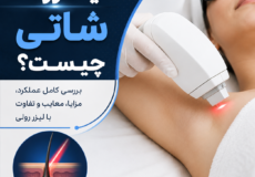 لیزر شاتی چیست
