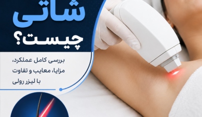 لیزر شاتی چیست