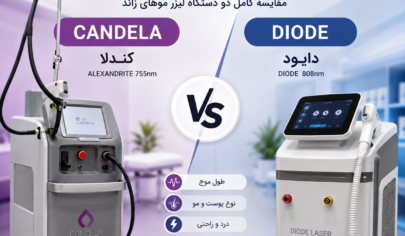 لیزر کندلا بهتر است یا دایود