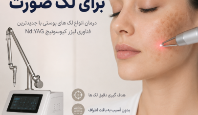 لیزر کیوسوئیچ برای لک صورت